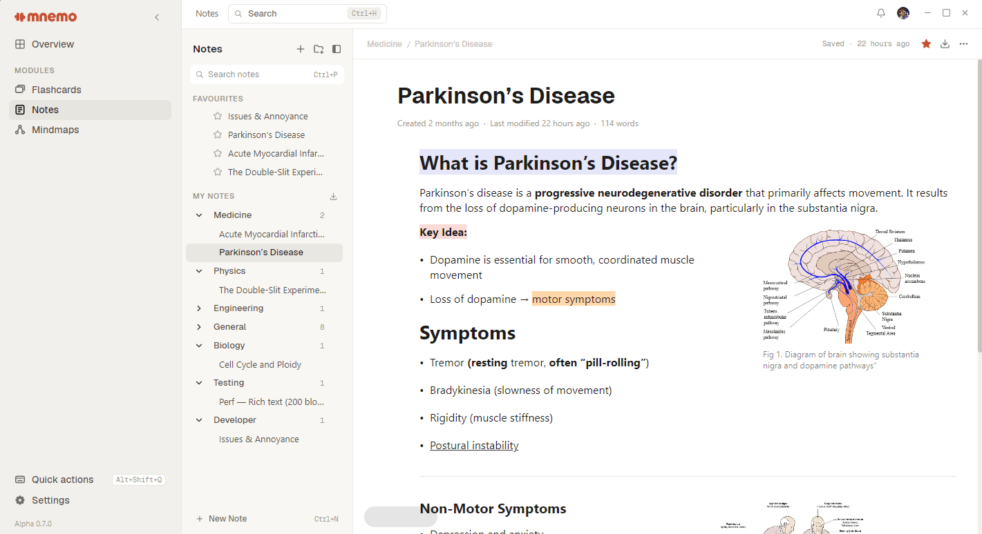 The Mnemo desktop app showing the block based notes editor with a note on Parkinson's disease