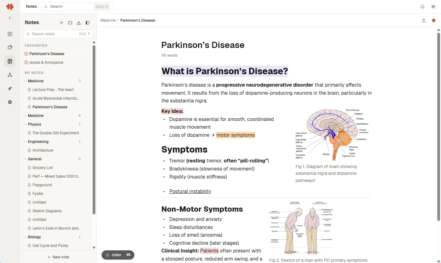 A later Mnemo editor showing notes on Parkinson’s disease, with Issues & Annoyance in the favourites list